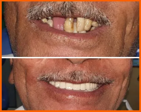 عيادة زراعة الأسنان المملكة العربية السعودية