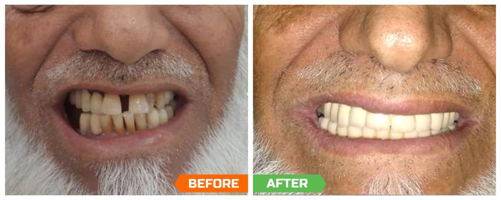 cosmetic dentist in gurgaon