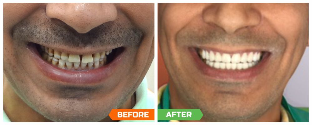 Mumbai Dental clinic